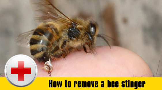 The Best 20 How To Draw Out A Bee Stinger - workstockinterest