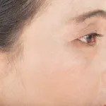 نفس البشرة بعد استخدام مجموعة بيولينا - تفتيح وتوحيد اللون