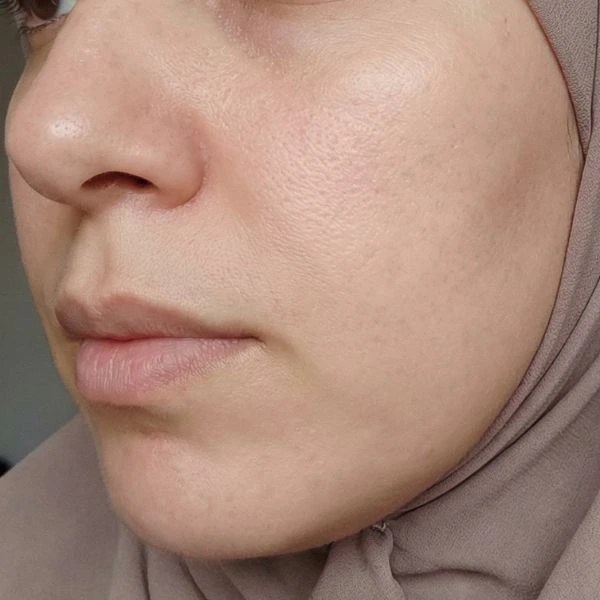 بعد