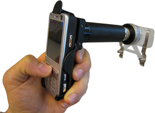 CellScope, teléfono móvil y microscopio