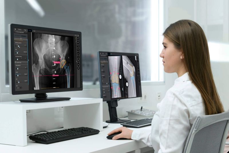 Orthopedic Templating Software Features To Look For Examples - Minimal Photos - Creative Full HD Collection