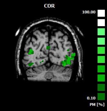 Probabilistic Maps From Volume Maps - Nature Designs - Classic 8K Collection