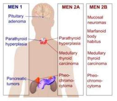 Which organs of the body are affected by MEN, multiple endocrine neoplasia, a rare disease?