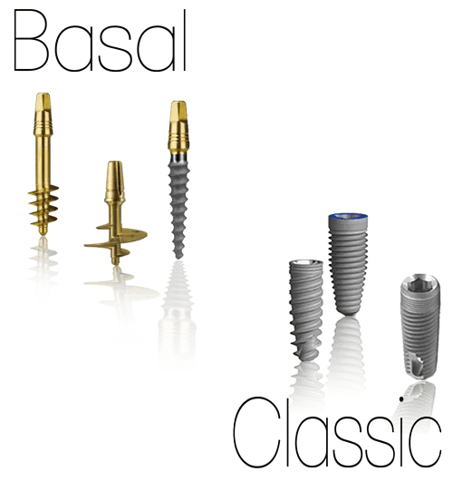 Basal Implants Why should you avoid them?