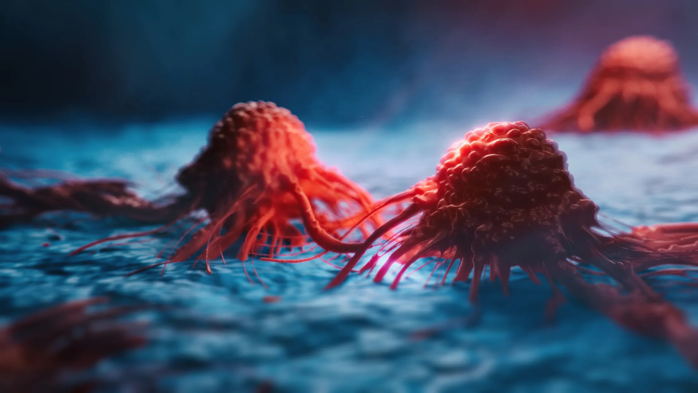 El cáncer de páncreas desactiva un gen