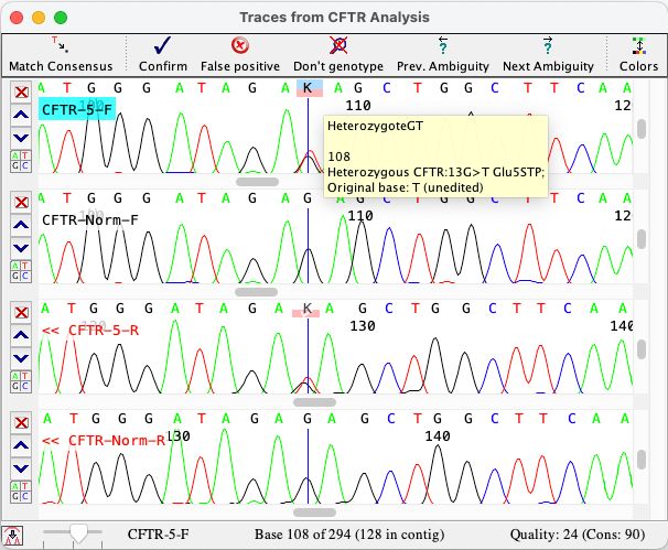 Mutation Detection Software For Sanger Sequencing Codoncode Aligner - Space Photo Collection - Mobile Quality