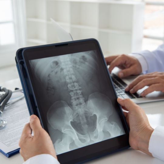 How much compensation do you need for a spinal cord injury?
