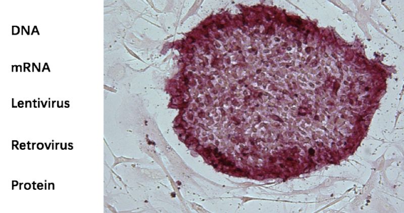 Ipsc Reprogramming Kits Creative Bioarray Creative Bioarray - Premium Mountain Image Gallery - Mobile