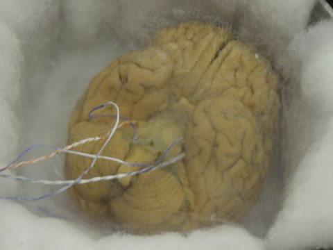 vitrified brain