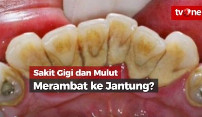 Cara Mengobati Penyakit Obat Sakit Gigi Modot