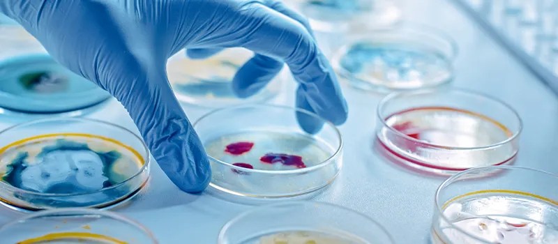 Common mistakes microbiology students make & how to avoid them