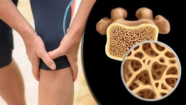 مركبات في الأطعمة النباتية تحمينا من هشاشة العظام