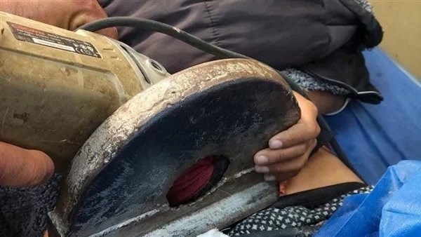 إنقاذ حياة طفل بعد إصابته بمنشار كهربائي في دمياط 