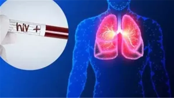 لأول مرة في العالم.. زراعة رئة بين مريضين بـ HIV تثير الجدل