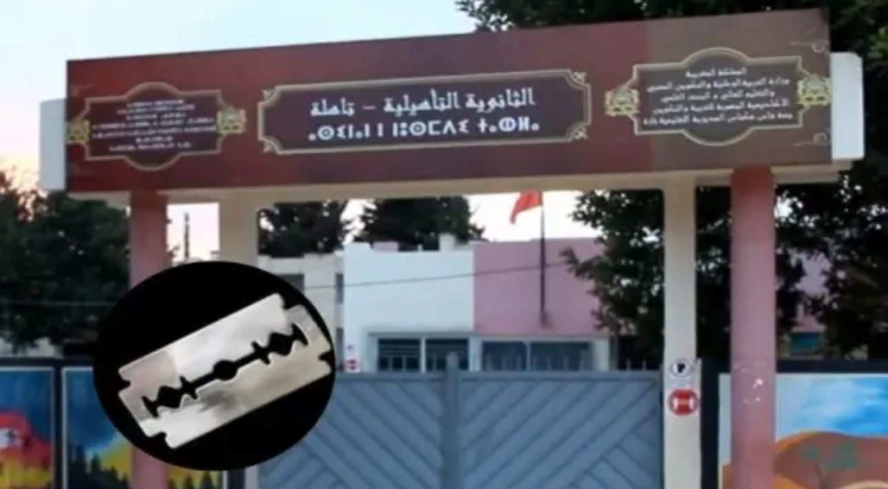 تلميذة تعتدي على أخرى بواسطة شفرة للحلاقة و ترسلها لقسم المستعجلات