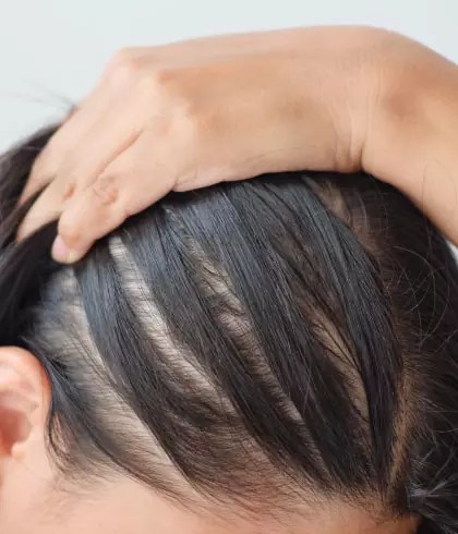 7 best haircut to prevent hair loss for female