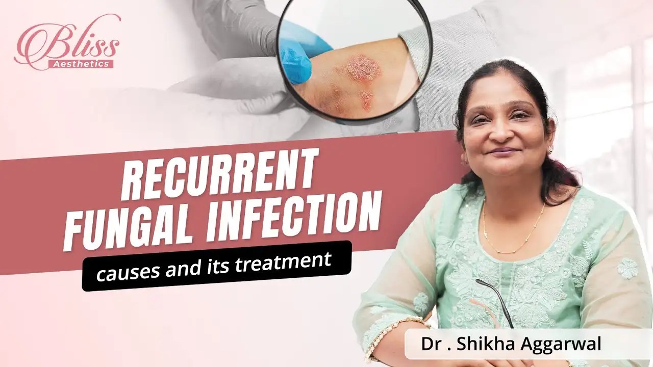 Recurrent Fungal Infection
