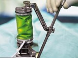 Mazor Robotics Renaissance Robotics Assisted Spine Surgery