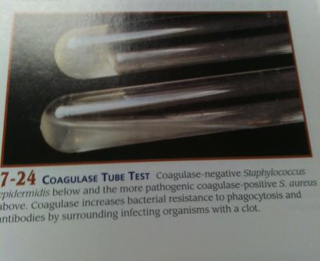 Most people will view the images differently (mostly arabic numbers). Diagnostic Media Flashcards for Test 3 Flashcards | Easy