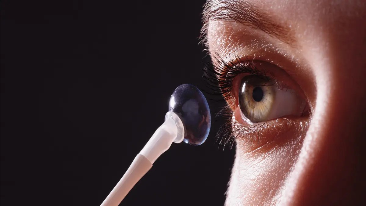 Up close photo of someone applying a scleral contact lens