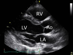 Ärzte mit der fachbezeichnung kardiologie sollten. echobasics