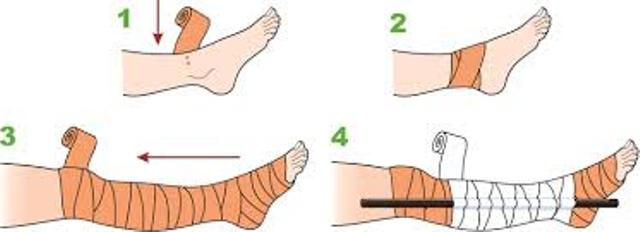 Snake Bite First Aid Protocol Pdf - Download Classic Abstract Wallpaper | 4K