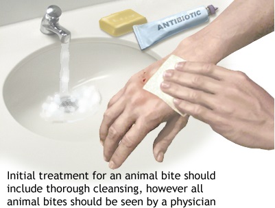 First Aid Animal Bites Health Safety Environment