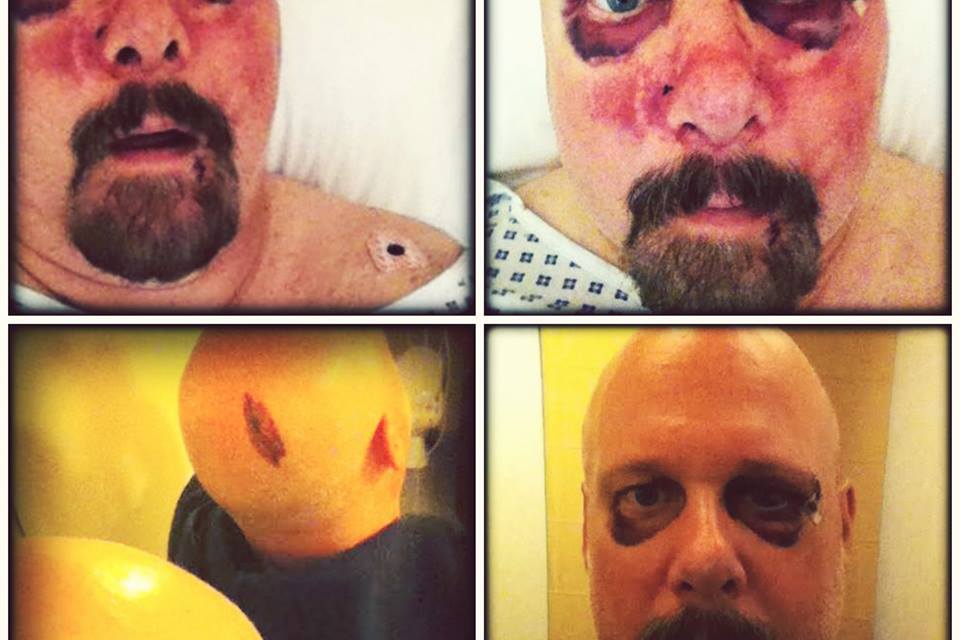 GARY MESKIL de PRO-PAIN agredido durante su gira por Europa