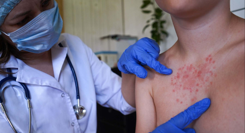 Sociedad Infectología alerta a RD sobre riesgo de sarampión