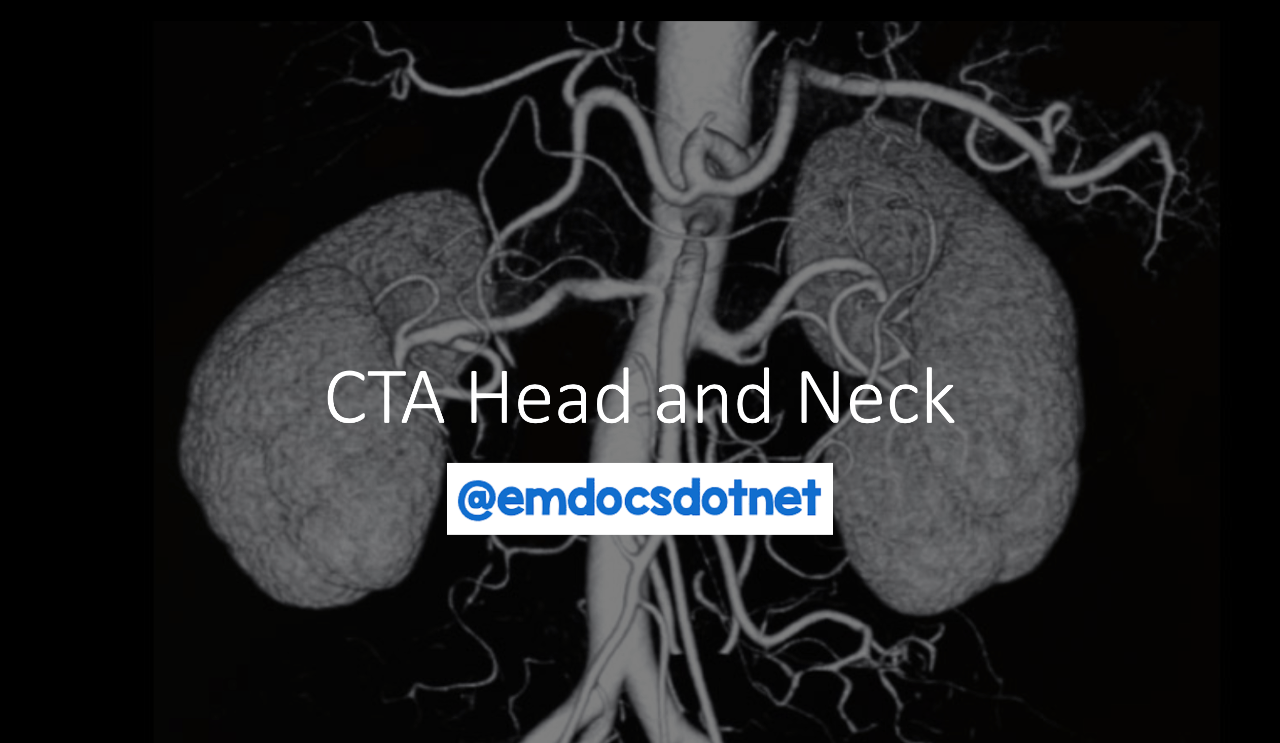 emDOCs.net – Emergency Medicine EducationCT Angiography Head and 
