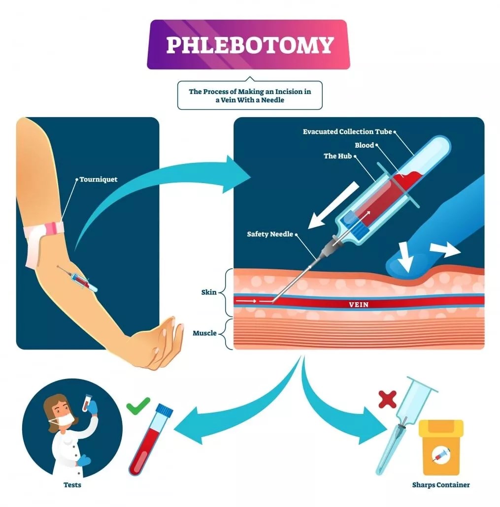 How To Anchor A Vein Phlebotomy E Phlebotomy Training