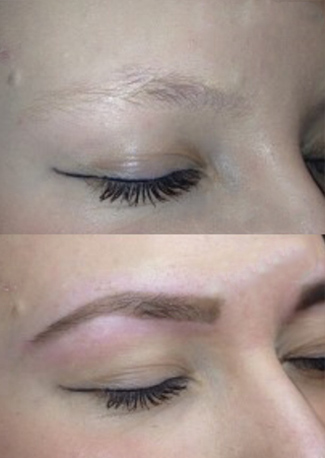 Hairstroke Permanent Cosmetic Eyebrow