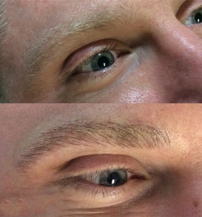Permanent Cosmetics Eyebrow Before and After