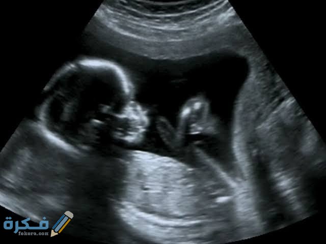 كم نسبة صحة السونار في الشهر الرابع