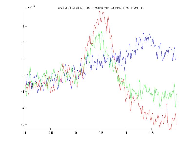 Solved Qstat And Qsub Help Intel Community - Best Geometric Photos in Retina