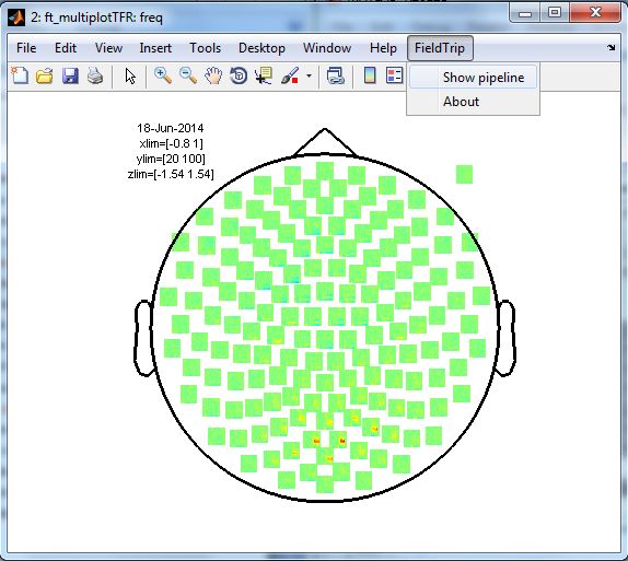 Analysis Of Sensor And Source Level Connectivity Fieldtrip Toolbox - Premium Space Pattern - Desktop