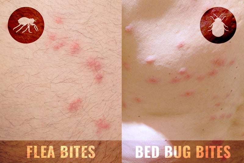 pics Flea Bites Vs Bed Bug Bites Vs Spider Bites flea bites vs bed bug bites what is the difference fleabites