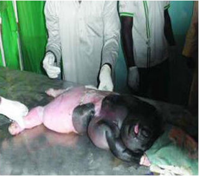 Human-like Abomination Found Inside Bowels of Slaughtered Sheep