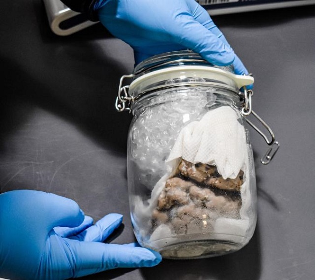 US Border Patrol Agents Find ‘Human Brain’ Inside Of Package Entering The USA