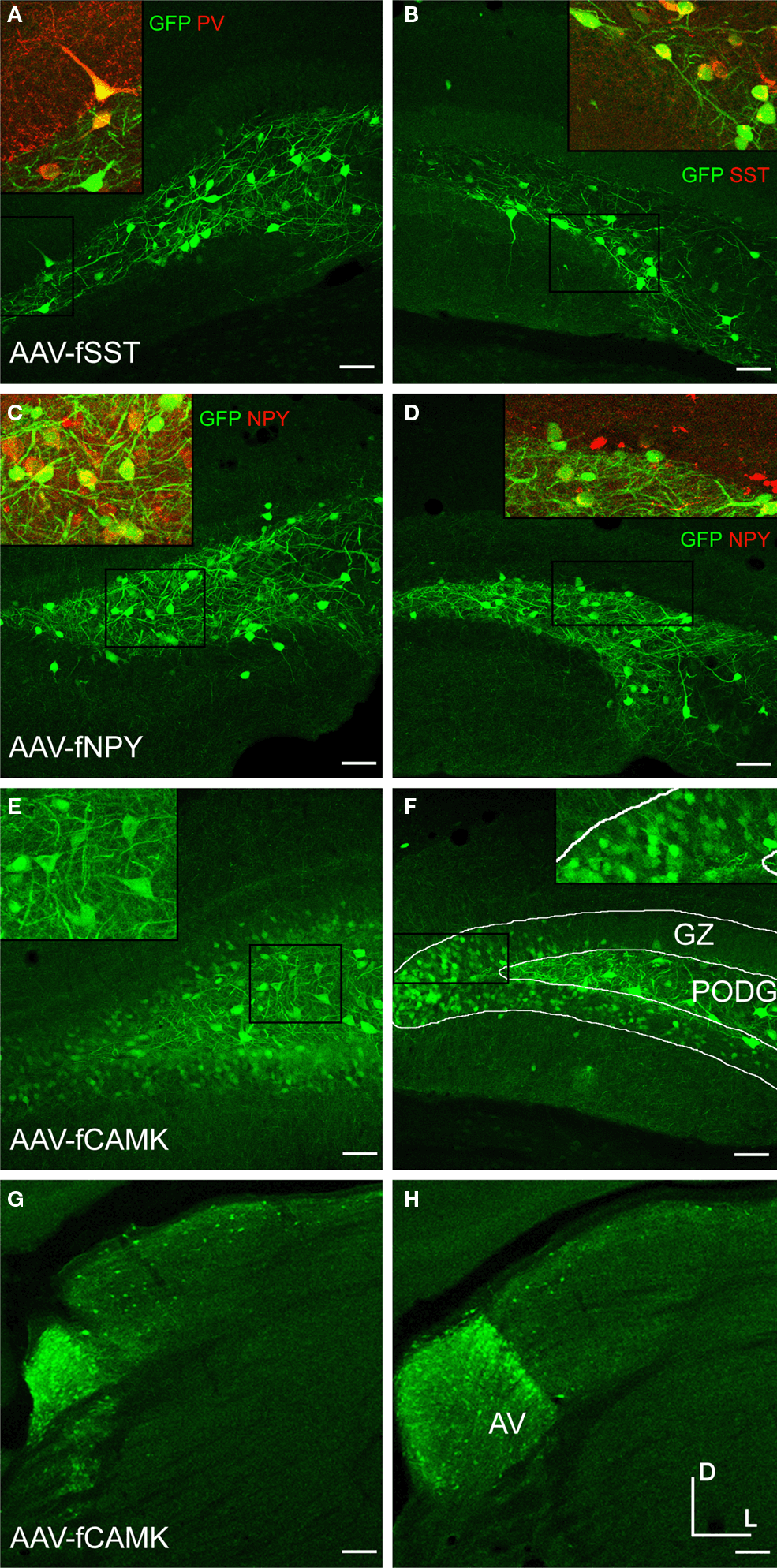 Camkii is involved in many signaling cascades and is thought to be an important mediator of learning and memory. Frontiers | Short promoters in viral vectors drive