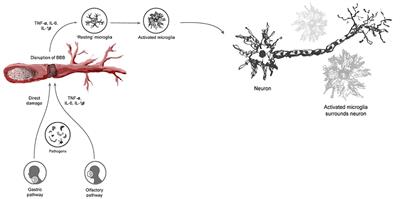 wallpapers Encephalitis Lethargica Brain frontiers