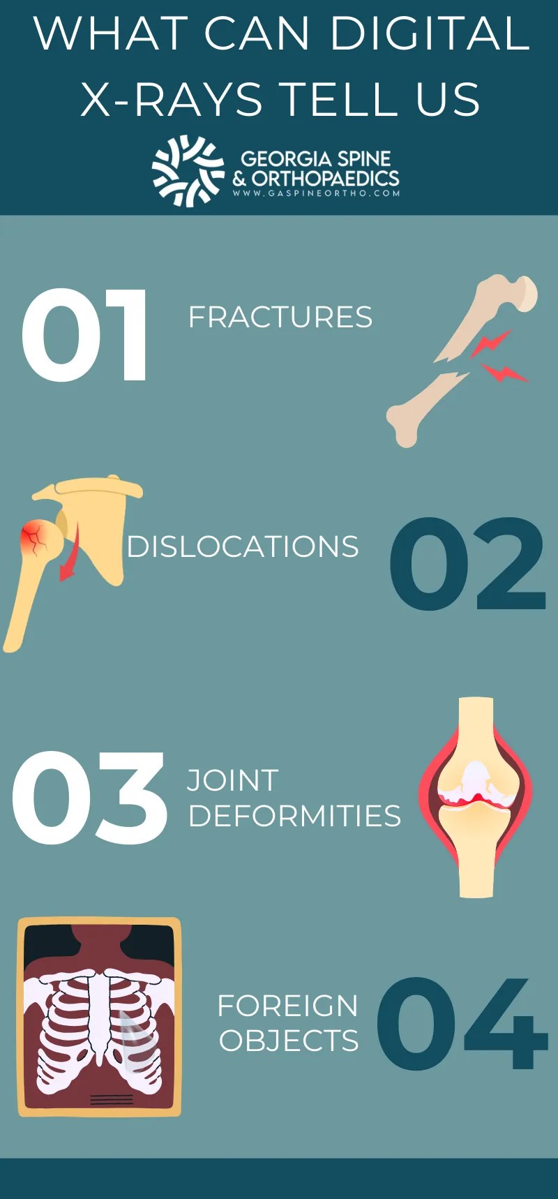 Atlanta x-ray services — georgia spine & orthopaedics