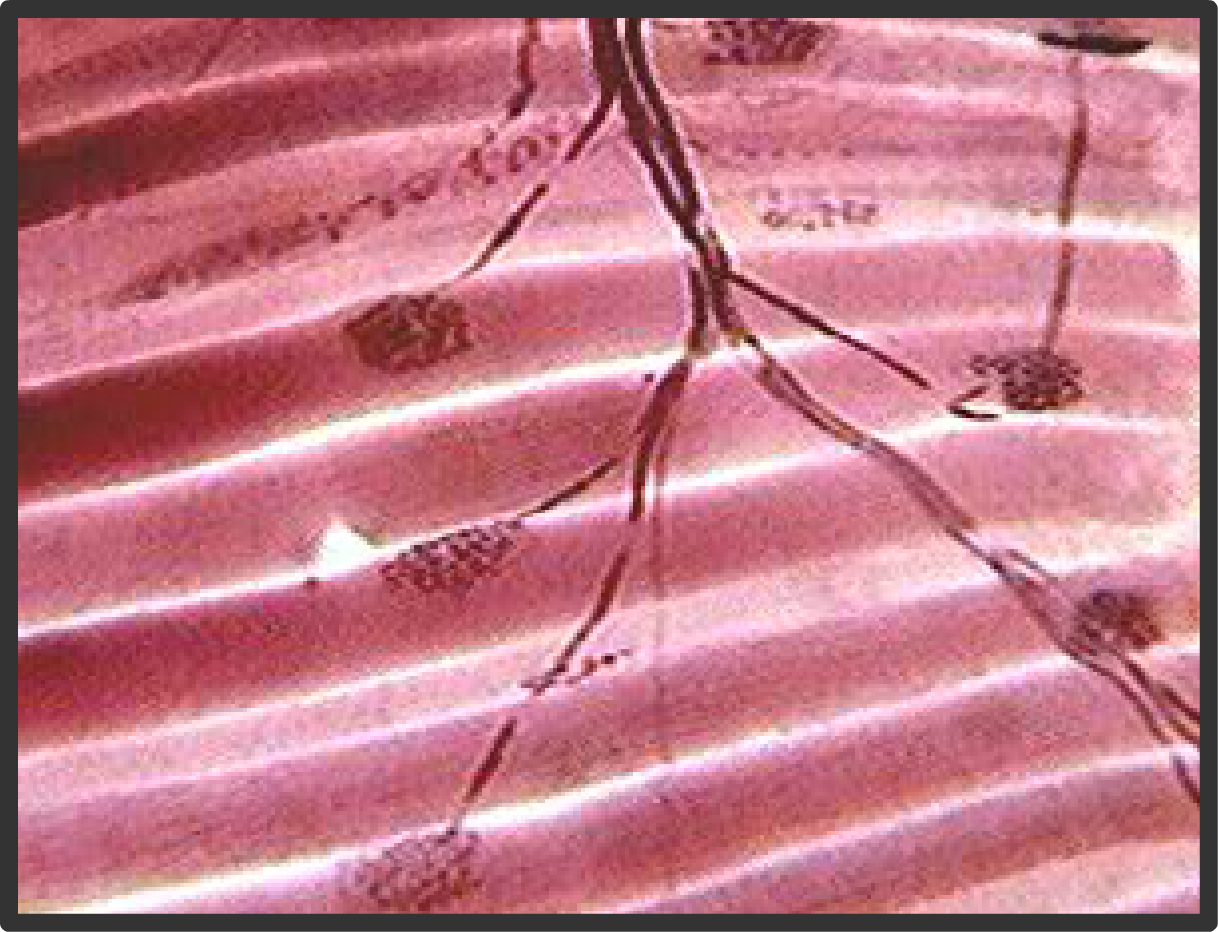 Motor unit define anatomy