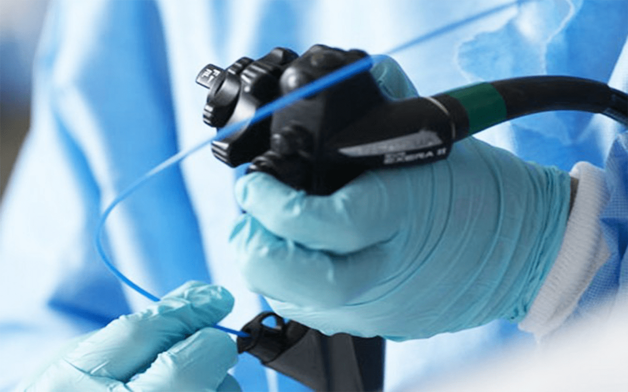 The side effects of endoscopy may be cramping, bloating, increased gas and sore throat, as stated by mayo clinic. All About Endoscopy - Get To Know From Dr Bertha Woon | GetDoc