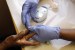 New Subtype of Maturity-Onset Diabetes