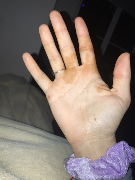 How do you get rid of orange water? What are these orange stains that have appeared on my
