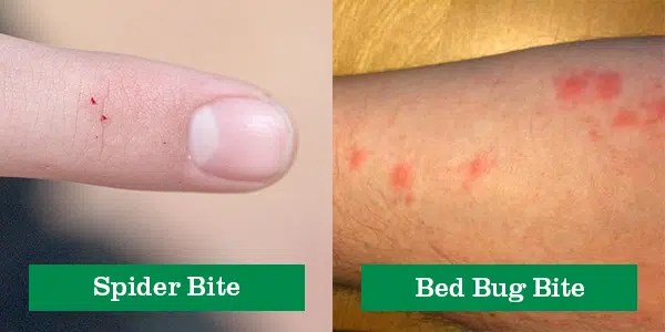 Bed Bug Bite Or Spider R Bugbites - Download Ultra HD Sunset Design | Full HD