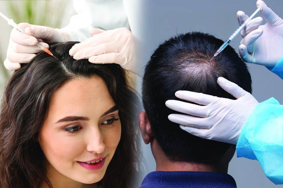 Hair Transplant