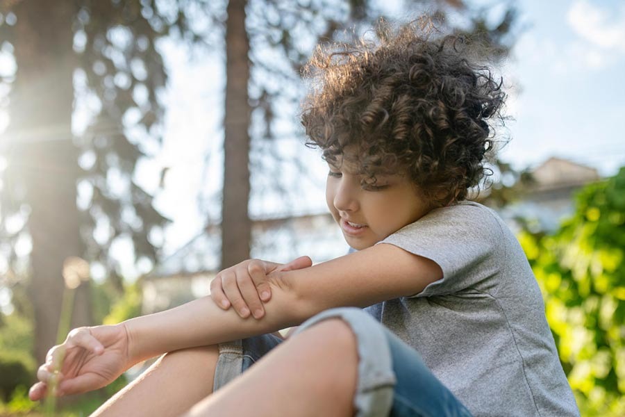 Summer Rashes: बच्चों को समर रैशेज से कैसे बचाएं