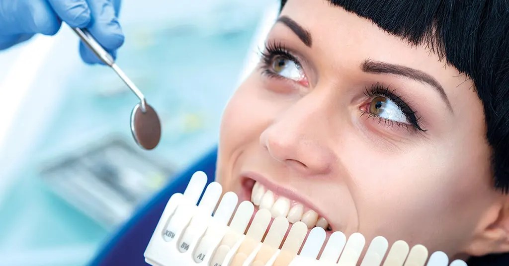 Faktor Penentu Harga Whitening Gigi Faktor Penentu Harga Whitening Gigi